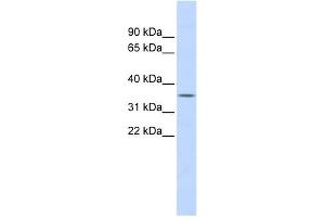 FCN1 antibody used at 1 ug/ml to detect target protein. (FCN1 antibody)