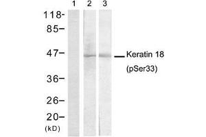 Western blot analysis of extracts from A431 cells (Lane 1 and 2) and EC-304 cells (Lane 3) using Keratin 18 (Phospho-Ser33) antibody (E011306). (Cytokeratin 18 antibody  (pSer33))