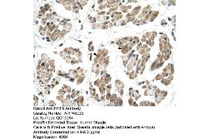 Human Muscle (Fukutin antibody  (N-Term))