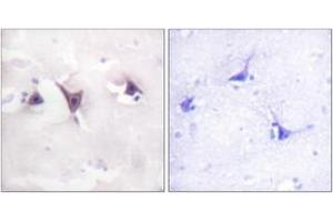 Immunohistochemistry analysis of paraffin-embedded human brain tissue, using Trk B (Ab-515) Antibody. (TRKB antibody  (AA 481-530))