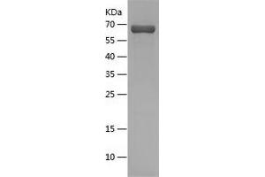 Western Blotting (WB) image for Cystathionase (Cystathionine gamma-Lyase) (CTH) (AA 1-405) protein (His-IF2DI Tag) (ABIN7122547) (CTH Protein (AA 1-405) (His-IF2DI Tag))