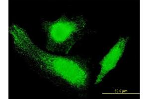 Immunofluorescence of monoclonal antibody to HTT on HeLa cell. (Huntingtin antibody  (AA 81-190))