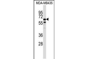 Western blot analysis in MDA-MB435 cell line lysates (35ug/lane). (TRIM39 antibody  (AA 248-277))