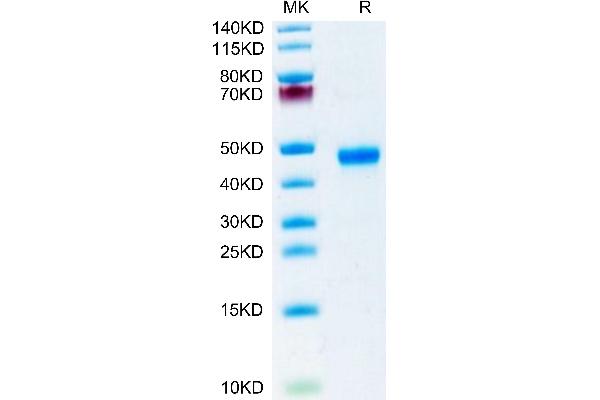 RSPO1 Protein (AA 21-265) (His tag)