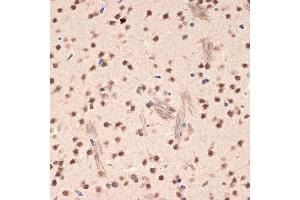 Immunohistochemistry of paraffin-embedded mouse brain using EHMT2 Rabbit mAb (ABIN7265616) at dilution of 1:100 (40x lens). (EHMT2 antibody)