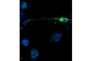 Phospho serine 129 antibody (ABIN5650947) was used to detect phosphorylated alpha synuclein in primary mouse hippocampal neurons treated with 100 nM sonicated mouse alpha synuclein PFFs (ABIN5651245) (A). (SNCA antibody  (pSer129) (Biotin))