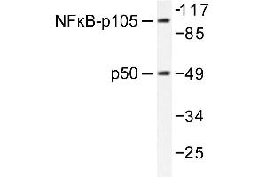 Image no. 1 for anti-Nuclear Factor of kappa Light Polypeptide Gene Enhancer in B-Cells 1 (NFKB1) antibody (ABIN271742)