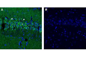 Free-floating frozen brain sections from a paraformaldehyde-perfused mouse were incubated with Anti-Synaptojanin 1 antibody (ABIN7885553, 1:300), followed by goat anti-rabbit secondary antibody conjugated to Alexa Fluor® 488 (green). (Synaptojanin 1 antibody  (Intracellular))
