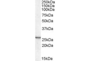 Image no. 2 for anti-Cysteine and Glycine-Rich Protein 2 (CSRP2) (Internal Region) antibody (ABIN374898) (CSRP2 antibody  (Internal Region))
