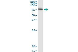 SERPING1 monoclonal antibody (M01), clone 3F4-1D9. (SERPING1 antibody  (AA 1-500))