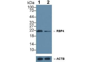Western blot analysis of (1) Wild-type HepG2 cell lysate, and (2) RBP4 knockout HepG2 cell lysate, using Rabbit Anti-Cow RBP4 Antibody (1 µg/ml) and HRP-conjugated Goat Anti-Mouse antibody ( (RBP4 antibody  (AA 19-201))