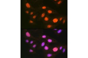 Immunofluorescence analysis of U-2 OS cells using UB Rabbit mAb (ABIN7271185) at dilution of 1:100 (40x lens). (UBA1 antibody)
