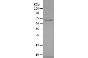 Western Blotting (WB) image for Heme Oxygenase (Decycling) 1 (HMOX1) (AA 1-267) protein (His-IF2DI Tag) (ABIN7282472) (HMOX1 Protein (AA 1-267) (His-IF2DI Tag))