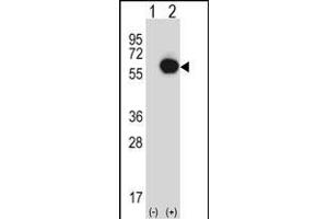 Western blot analysis of RANG (arrow) using rabbit polyclonal RANG Antibody (N-term) 3776a. (RANGAP1 antibody  (N-Term))