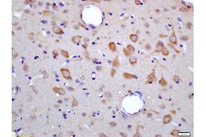 Formalin-fixed and paraffin embedded rat brain labeled with Rabbit Anti-HES6 Polyclonal Antibody, Unconjugated (ABIN1387271) at 1:200 followed by conjugation to the secondary antibody and DAB staining (HES6 antibody  (AA 1-80))