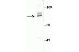 Western blot of HeLa cell lysate showing specific immunolabeling of the ~90 kDa RSK2 protein.