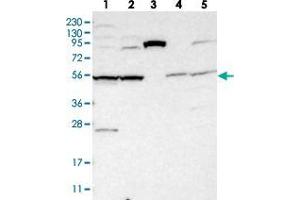 Western blot analysis of Lane 1: RT-4, Lane 2: U-251 MG, Lane 3: Human Plasma, Lane 4: Liver, Lane 5: Tonsil with SLC35F1 polyclonal antibody  at 1:250-1:500 dilution.