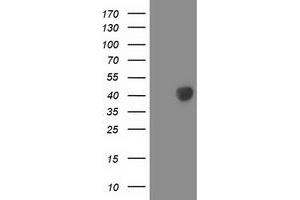 HEK293T cells were transfected with the pCMV6-ENTRY control (Left lane) or pCMV6-ENTRY LCMT1 (Right lane) cDNA for 48 hrs and lysed. (LCMT1 antibody)