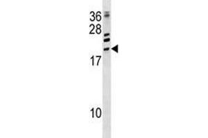 ATF3 antibody western blot analysis in CEM lysate. (ATF3 antibody  (AA 140-168))