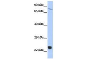 Image no. 1 for anti-SP110 Nuclear Body Protein (SP110) (AA 612-661) antibody (ABIN6742727) (SP110 antibody  (AA 612-661))