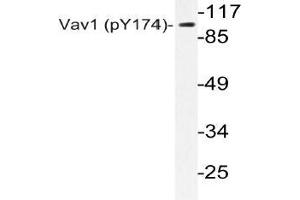 Western blot (WB) analyzes of p-Vav1 antibody in extracts from Jurkat UV cells. (VAV1 antibody  (pTyr174))