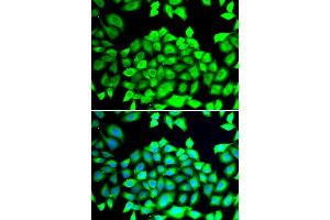 Immunofluorescence analysis of HeLa cell using CLCN7 antibody. (CLCN7 antibody)