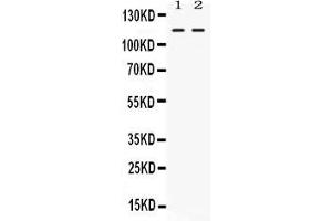 Western blot analysis of Argonaute 4 expression in rat thymus extract ( Lane 1) and 22RV1 whole cell lysates ( Lane 2).