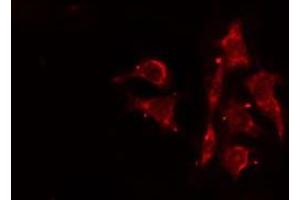 ABIN6276478 staining Hela cells by IF/ICC.