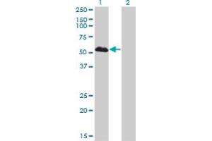 Western Blot analysis of FOXA1 expression in transfected 293T cell line by FOXA1 monoclonal antibody (M01), clone 2D7. (FOXA1 antibody  (AA 367-472))