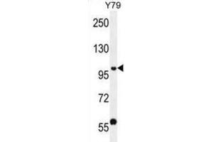 Western Blotting (WB) image for anti-PHD Finger Protein 20 (PHF20) antibody (ABIN2996558)