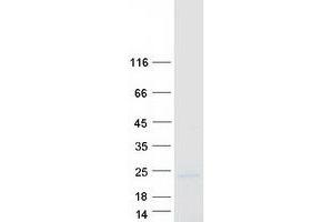 Validation with Western Blot (CPLX2 Protein (Transcript Variant 1) (Myc-DYKDDDDK Tag))