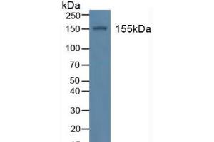 Figure. (Insulin Receptor antibody  (AA 1027-1364))