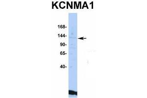 Host:  Rabbit  Target Name:  KCNMA1  Sample Type:  HepG2  Antibody Dilution:  1. (KCNMA1 antibody  (C-Term))