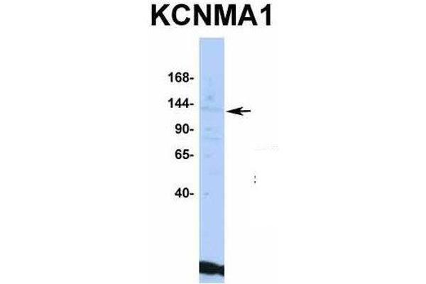 KCNMA1 anticorps  (C-Term)
