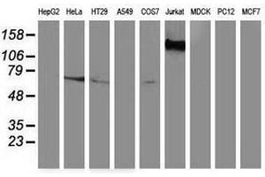 Image no. 2 for anti-Guanylate Binding Protein 5 (GBP5) antibody (ABIN1498408) (GBP5 antibody)