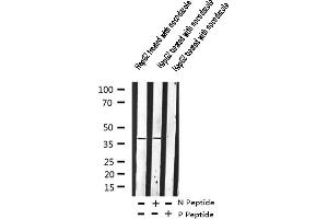 Western Blotting (WB) image for anti-Adrenergic, beta-2-, Receptor, Surface (ADRB2) (pSer346) antibody (ABIN6256279)