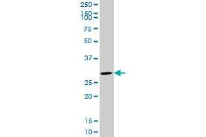 CDK4 monoclonal antibody (M09), clone 8A10. (CDK4 antibody  (AA 211-303))
