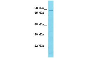 Western Blotting (WB) image for anti-TBC1 Domain Family, Member 17 (TBC1D17) (Middle Region) antibody (ABIN2791179) (TBC1D17 antibody  (Middle Region))