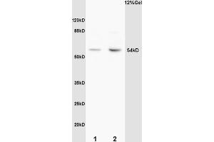 SDS-PAGE (SDS) image for anti-Myocyte Enhancer Factor 2A (MEF2A) (pThr312) antibody (ABIN743768)
