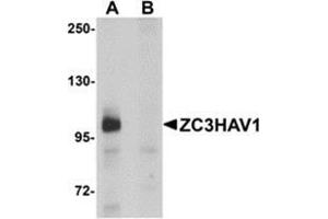 Western blot analysis of ZC3HAV1 in HeLa cell lysate with ZC3HAV1 antibody at 1μg/ml in (A) the absence and (B) the presence of blocking peptide.