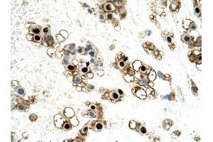 UNCX antibody was used for immunohistochemistry at a concentration of 4-8 ug/ml to stain Trophoblast cells (arrows) in Human Placenta. (UNCX antibody  (C-Term))