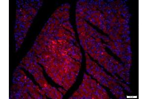 Immunofluorescence (Paraffin-embedded Sections) (IF (p)) image for anti-Family with Sequence Similarity 134, Member B (FAM134B) (AA 210-310) antibody (ABIN1714363)