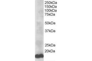 Image no. 1 for anti-Ubiquitin-Conjugating Enzyme E2L 3 (UBE2L3) (C-Term) antibody (ABIN374293)