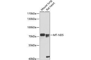 Western blot analysis of extracts of various cell lines, using MT-ND5 antibody (ABIN6135115, ABIN6144434, ABIN6144436 and ABIN6216103) at 1:1000 dilution. (MT-ND5 antibody  (AA 300-400))
