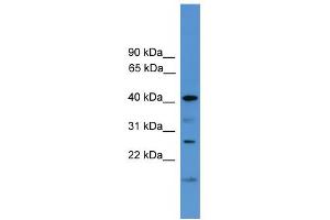 WB Suggested Anti-SCAMP1 Antibody Titration: 0. (SCAMP1 antibody  (Middle Region))