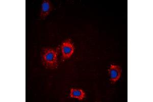 Immunofluorescent analysis of AKT staining in MCF7 cells. (AKT1 antibody  (Center))