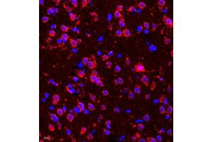 Immunofluorescence of paraffin embedded rat brain using deltex (ABIN7073794) at dilution of 1:200 (400x lens)
