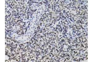 Immunohistochemistry of paraffin-embedded human tonsil using TMPO Antibody (ABIN1875122) at dilution of 1:100 (40x lens). (Thymopoietin antibody)