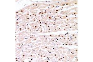 Immunohistochemical analysis of Cyclin E1 (pT77) staining in human heart formalin fixed paraffin embedded tissue section. (Cyclin E1 antibody  (pSer77))