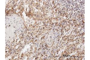 Immunoperoxidase of purified MaxPab antibody to TPP1 on formalin-fixed paraffin-embedded human spleen. (TPP1 antibody  (AA 1-563))